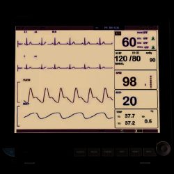 MONITOR MULTIPARAMETRO