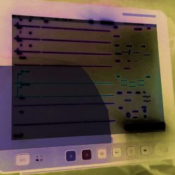 MONITOR MULTIPARAMETRO